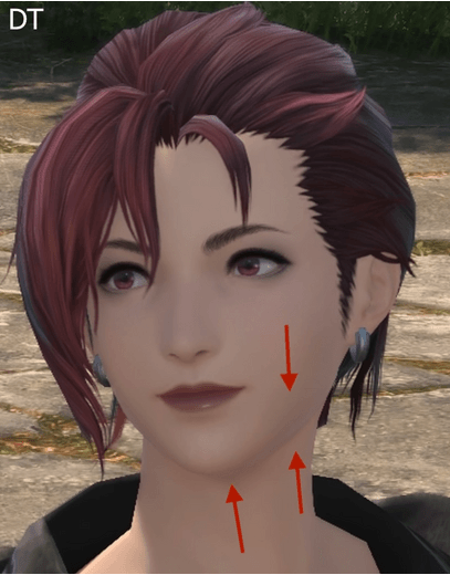 jaw2.gif